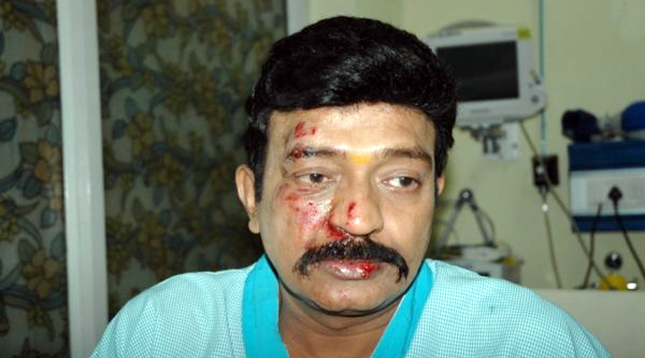 సెట్స్లో గాయపడిన 'రాజశేఖర్' 1 5 15