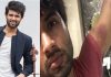 Vijay Deverakonda meets with accident, slips from moving train