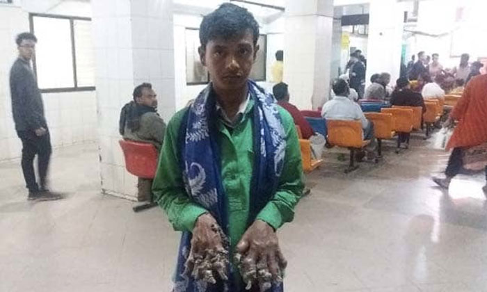 bangaldesg tree man a