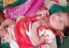 Baby born with heart right side in Medak