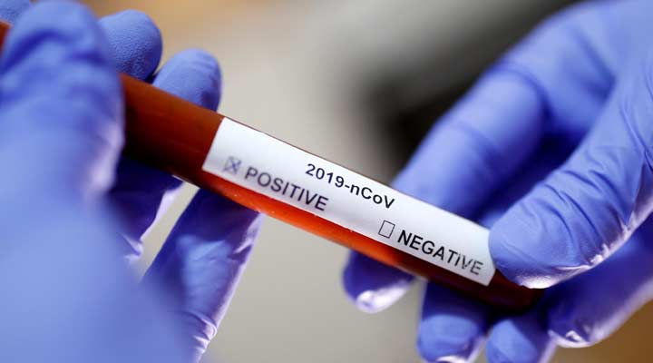 తెలంగాణలో ఇద్దరు డాక్టర్లకు కరోనా పాజిటివ్ 1 6 25