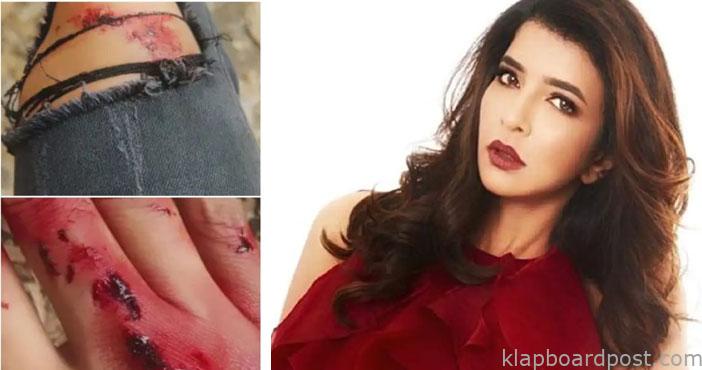 Manchu lakshmi injured phot