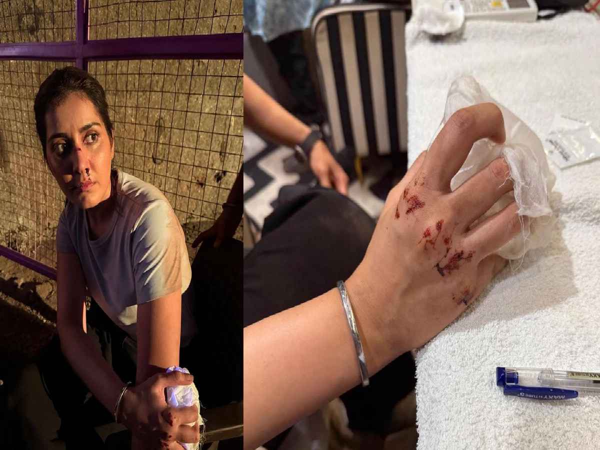 హీరోయిన్ Raashi Khanna కి తీవ్ర గాయాలు.. వైరల్ అవుతున్న ఫోటోలు 1 Raashi Khanna Injured Shares Photos Here Is What Happened